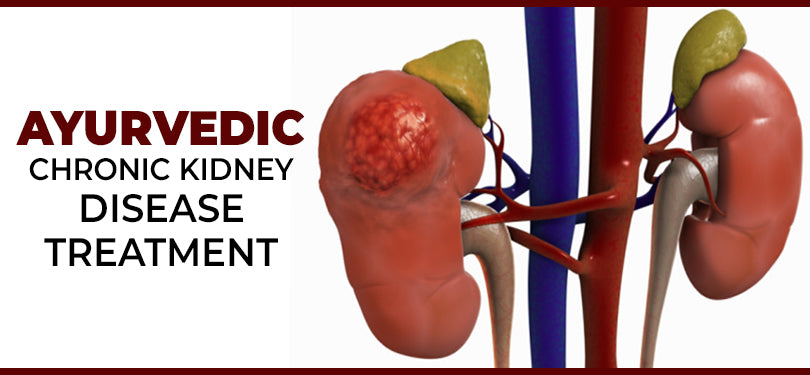 Ayurvedic Treatment & Medicines For Kidney Disease